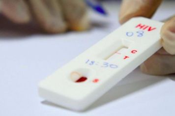 Saúde intensifica testagem de HIV para a campanha do Dezembro Vermelho
