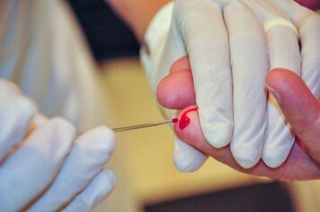 Saúde realiza 357 testes de hepatites virais em Pompeia