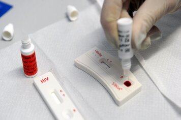 Unidades de Saúde intensificam ações de combate ao HIV