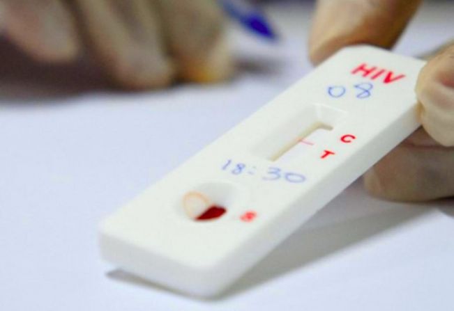 Saúde intensifica testagem de HIV para a campanha do Dezembro Vermelho